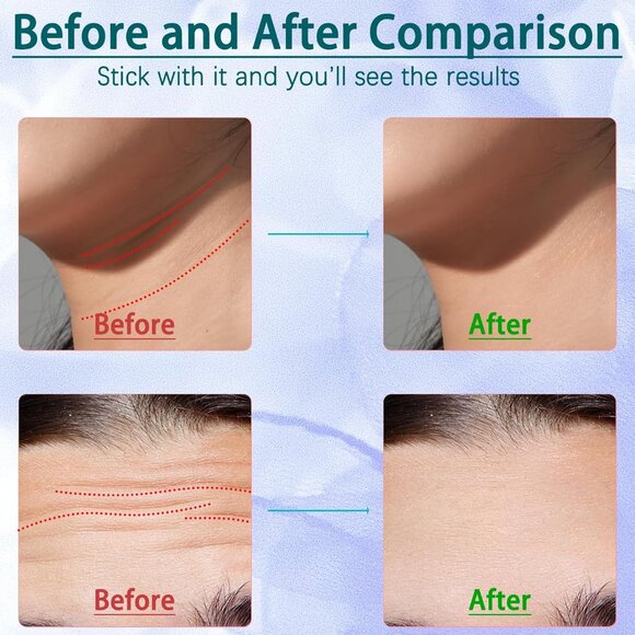 Face and Neck Massager Tool, 7-in-1 Color Red-Light-Therapy Wand for Skin Care - Picture 5 of 6